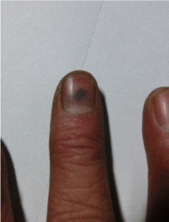 Image1