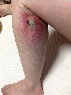 Img_18441
