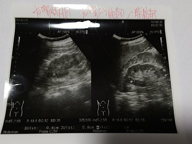 Img_20170701_0113371