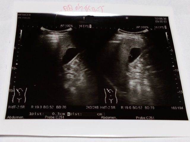 Img_20170701_0114161